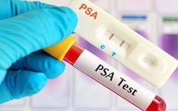 3 ca ung thư tuyến tiền liệt trong 1 ngày, bác sĩ chỉ lý do bệnh dễ bị bỏ sót