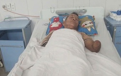 Tin mới liên quan cụ ông cụt 2 tay kẹp con rắn hổ mang dài 2 mét