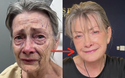 Bác sĩ thẩm mỹ được đặt lịch ồ ạt tới tận... 50 năm sau nhờ màn cải lão hoàn đồng thành công cho khách hàng