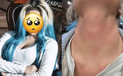 Nữ ca sĩ bị hành hung nghiêm trọng, còn bị ép viết thư xin lỗi