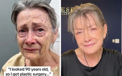 Cụ bà trông như 90 tuổi trẻ hóa kỳ diệu sau phẫu thuật căng da