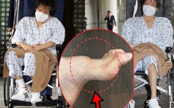 Gia tộc Samsung và căn bệnh di truyền đáng sợ mang tên teo cơ MÁC: Có tất cả nhưng cũng không thể chữa khỏi