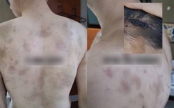 Rúng động Hàn Quốc: Nam nhân viên bị chủ quán hành hạ, ép làm việc 20 giờ/ngày, camera giám sát 24/7