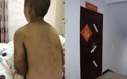 Bi kịch của cậu bé 14 tuổi vẫn phải mặc tã