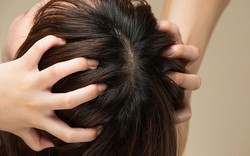 Bác sĩ cảnh báo 5 thành phần “độc hại” trong dầu gội cần tránh