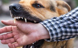 Người đàn ông 63 tuổi tử vong sau khi bị chó cắn lúc tập thể dục