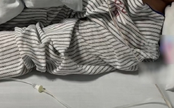 Chàng trai 30 tuổi mắt phải bỗng bị mờ, đi khám bác sĩ kết luận: Hệ miễn dịch đã bị tổn hại hoàn toàn