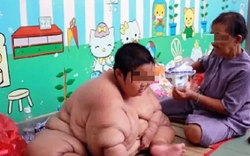 Đại dịch béo phì bùng phát, ca bệnh tăng chóng mặt tại Việt Nam