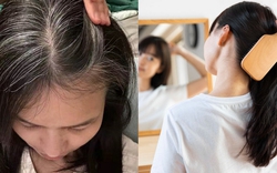 Nhiều người chưa 30 tuổi đã bạc tóc: 3 nhóm người dễ có tóc bạc nhất và 3 cách đơn giản giúp tóc đen lâu hơn