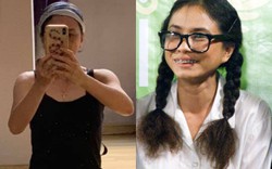 Nữ NSƯT đóng vai Cô Gái Xấu Xí bị 28 vết xẹo trên mặt vì tai nạn, cuộc sống hiện tại ra sao?