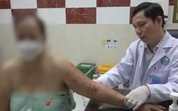 Zona thần kinh tiềm ẩn nhiều biến chứng nghiêm trọng