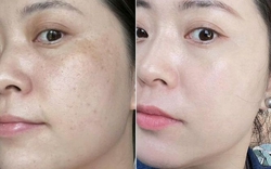 Làm 6 việc này trước khi đi ngủ, làn da của tôi như “tái sinh” về năm 20