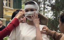 Hình ảnh Ngọc Trinh băng bó kín cả mặt