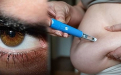 Giảm 10kg sau 4 tháng tiêm “bút giảm cân”, người đàn ông bàng hoàng khi tỉnh dậy bị đột quỵ mắt, một bên không nhìn thấy gì