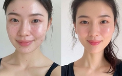 Sáng thức dậy làm 5 việc này, da dẻ đẹp lên từng ngày, nếp nhăn khó mà xuất hiện