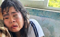 Nữ sinh lớp 7 bị 2 nam sinh lớp 9 đánh nhập viện