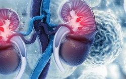 Thận xuống cấp nhanh chóng nếu ăn quá nhiều 9 loại thực phẩm này: Toàn món khoái khẩu của nhiều người