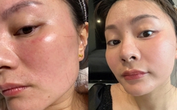 Tôi từng “ném tiền qua cửa sổ” vì mê spa, cho đến khi nhận ra: Chỉ cần 3 phút đắp lotion mỗi ngày, da cũng có thể đẹp lên