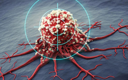 Một năm trước khi ung thư phát triển, cơ thể sẽ phát ra 5 dấu hiệu cảnh báo, nhưng 90% người lại bỏ qua