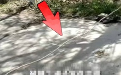 Đạp xe vướng dây giăng ngang đường, cậu bé bị siết cổ đến vỡ khí quản, nguy kịch