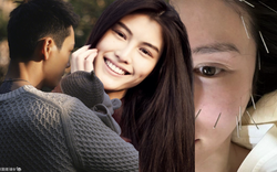 Vợ tổng tài hot nhất Trung Quốc ghim hàng chục cây kim lên mặt để ngăn xệ sau sinh