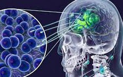 Thông tin liên quan ca dương tính viêm não mô cầu ở Cà Mau