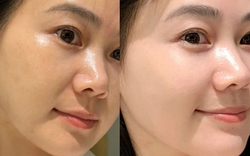 Tôi "bơm nước" cho da căng mọng, "hồi sinh" da khô sần chỉ với 5 việc làm này