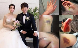 Anh trai Jisoo (BLACKPINK) lại trở thành tâm điểm phẫn nộ: Bị tố bạo hành gia đình, bắt vợ phải quỳ gối xin tha?