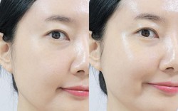 5 thói quen đơn giản giúp da "lâu già", càng làm sớm càng có lợi