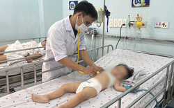 Chủng EV71 khiến ca tay chân miệng nặng tăng, TP.HCM dự phòng kịch bản quá tải