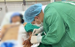 Vi khuẩn 'ăn mòn' bàn tay sau mũi tiêm, người phụ nữ suýt mất mạng