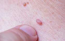 Phụ nữ từng quan hệ tình dục nên biết