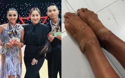 Cận cảnh đôi chân rớm máu, băng bó chằng chịt của kiện tướng Thu Hương khi cùng Phan Hiển giành 3 HCV Đông Nam Á