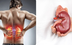 Nghiên cứu trên 417 người chỉ ra 5 ĐIỂM chung của người suy thận: Nhiều thói quen người Việt vẫn vô tình làm mỗi ngày