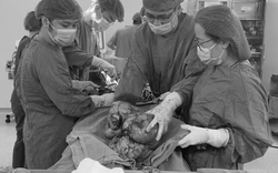 Đau âm ỉ vùng bụng suốt, người phụ nữ sốc khi bác sĩ lấy ra thứ "đáng sợ" trong cơ thể mình