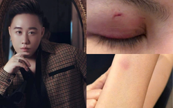 Ca sĩ Trung Quân Idol bị tố hành hung phụ nữ: Luật sư nói gì về trách nhiệm pháp lý?