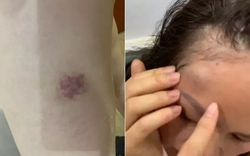 Hà Nội: Công an vào cuộc vụ một gia đình tố bị hàng xóm liên tục đe dọa, hành hung