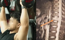 Người đàn ông 34 tuổi xương giòn như bà cụ 60 tuổi vì ngày nào cũng uống 3 cốc loại nước nhiều người không thể sống thiếu