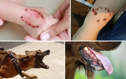 3 người bị chó dại cắn tử vong, TPHCM cảnh báo nóng