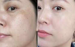 Làm 4 việc này khi thức giấc, làn da tôi “tươi mới” lúc nào không hay