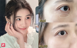 5 kem mắt kiêm thanh massage "2 trong 1" giúp ngừa lão hóa, chống rãnh nhăn li ti