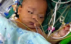 Kỳ lạ em bé 5 tháng tuổi nôn mửa và chán ăn nhưng không khóc tiếng nào, bác sĩ phát hiện sự thật đáng sợ phía sau