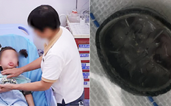 Bé gái 6 tuổi chảy máu vùng kín suốt 4 năm, đi khám mới phát hiện thứ “không ai ngờ” bên trong