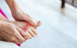 Chế độ ăn cho người bị bệnh gout: Khuyên dùng 4 “cao thủ” hạ axit uric, đậu phụ là một trong số đó