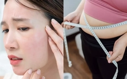 Không phải do bạn lười tập: Đây mới là lý do khiến nhiều người không thể "đốt mỡ", càng giảm cân càng thấy mụn