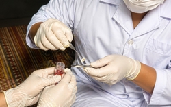 Món quà ánh sáng từ đôi giác mạc của người phụ nữ 61 tuổi