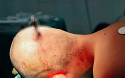 Tôi bàng hoàng khi đọc bài CẢNH BÁO từ Bệnh viện Việt Đức: Có những trò đùa của học sinh, còn dung túng sẽ gây hậu quả khôn lường!