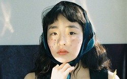 Các bác sĩ khuyên: Không cần chờ tới lúc ngứa da, thấy 7 dấu hiệu này trên mặt tức là máu đã "ngập đường"