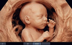 Bác sĩ nghẹn lòng trước mong muốn của sản phụ: "Bác… cố chụp cho con em một tấm ảnh thật đẹp… để làm kỷ niệm"