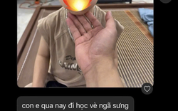 Con đi học về bị ngã sưng tím, phụ huynh nhắn tin "tag all" nhóm lớp lúc 9h tối gây tranh cãi khắp MXH